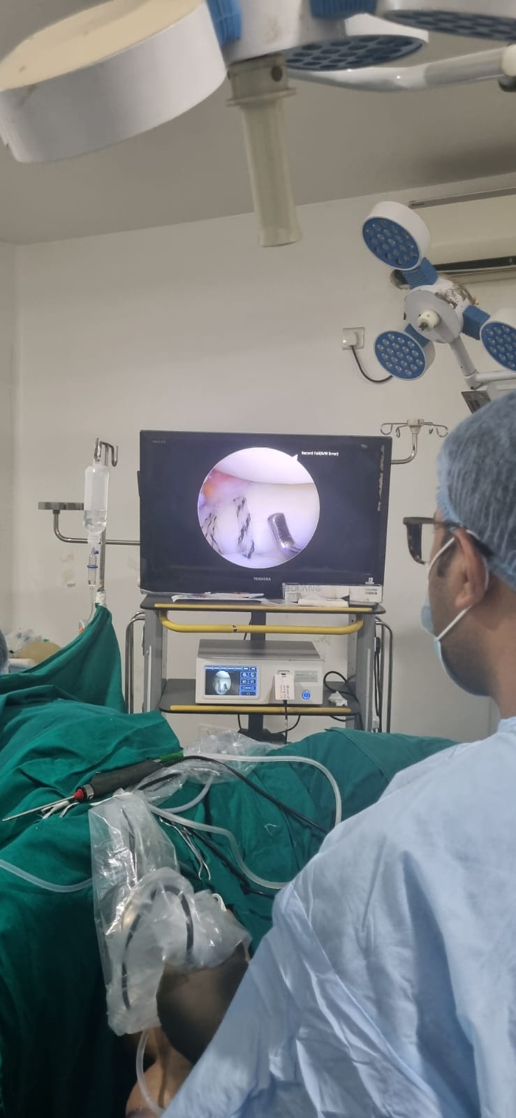 Arthroscopy